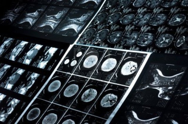 9486310-several-ct-computer-tomography-scan-images-of-neck-and-brain